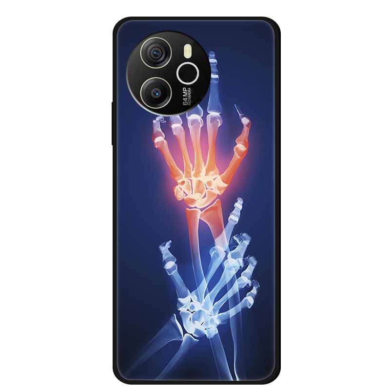 For Blackview Shark 8 Back Cover Case Fashion Photos Black Silicone Soft Phone Case For Blackview Shark 8 Case Shark8 Shell Capa