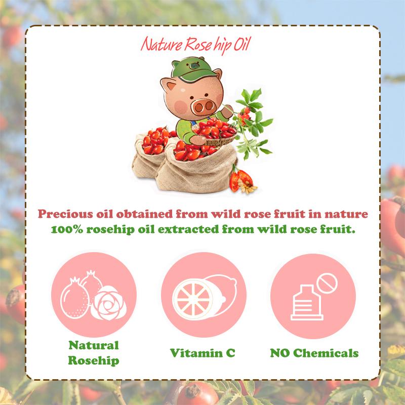 Elizavecca Farmer Piggy Oil 100% 30ml (5 Different Quantities With Argan & Rosehip)