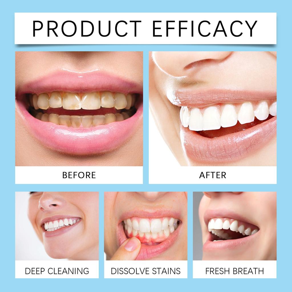 Probiotická bělící zubní pasta Hluboce čistí a chrání zuby Ústní péče Bělící zubní pasta na odstranění skvrn