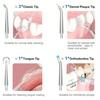 Oral Irrigator Portable Dental Water Flosser USB Rechargeable Water Jet Floss Tooth Pick 4 Jet Tip 220ml 3 Modes Teeth Cleaner