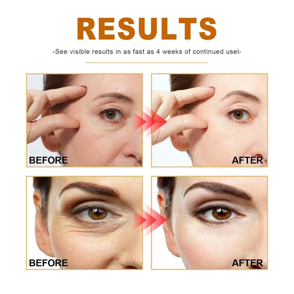 Collagen Anti-wrinkle White Serum
