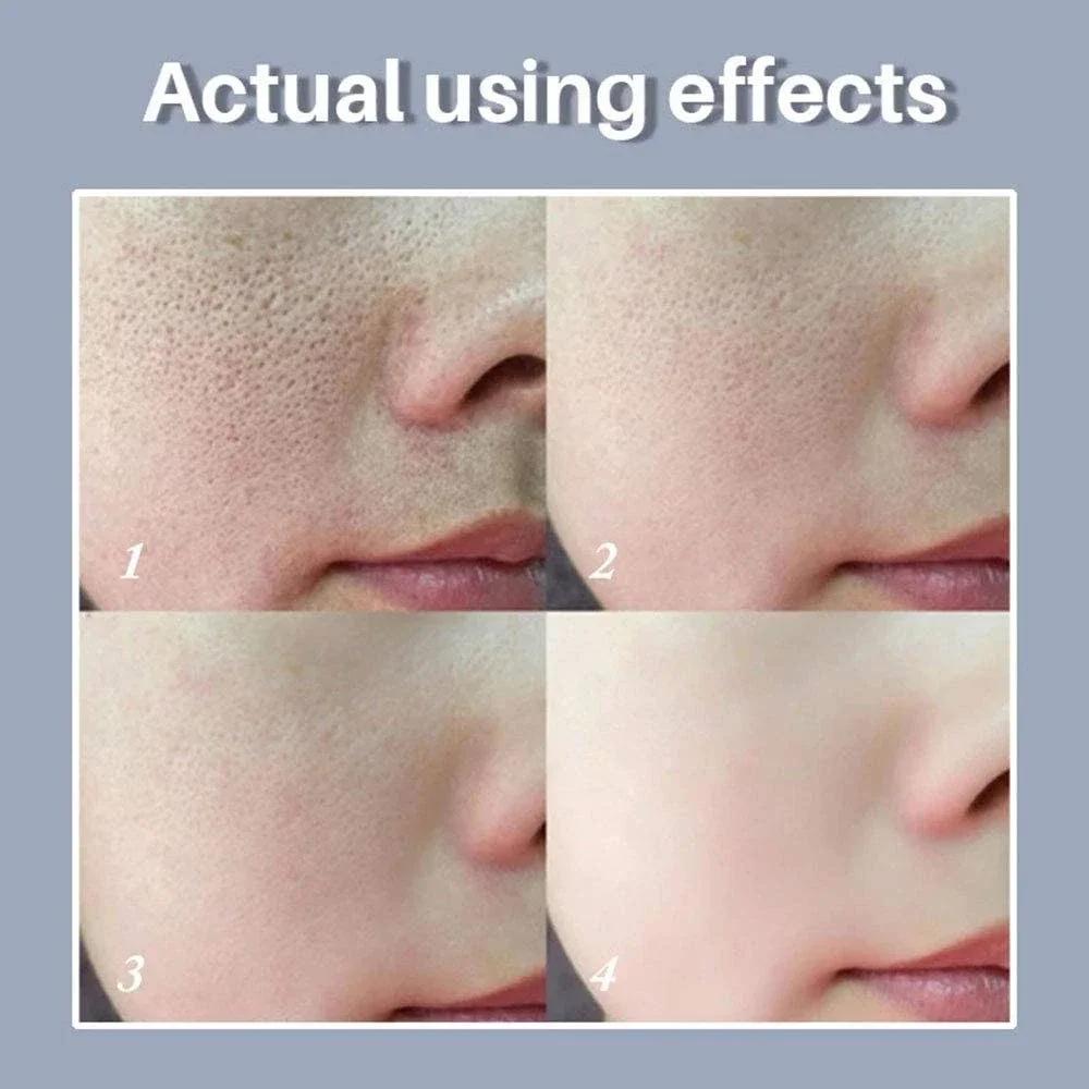 Siero Viso Levigante e Affinante dei Pori con Retinolo e Niacinamide Illuminante Non Comedogeno