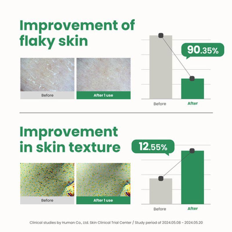 [AXIS-Y] PHA Resurfacing Glow Peel 50ml