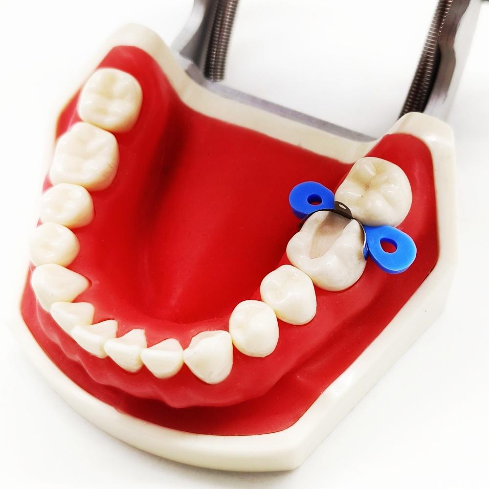 100Pcs/Set Dental Orthodontic Sectional Contoured Matrices Matrix Set Dental Plastic Wedge Rubber Wedges Ortho Matrice Material