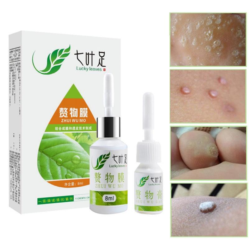 callus remover cream