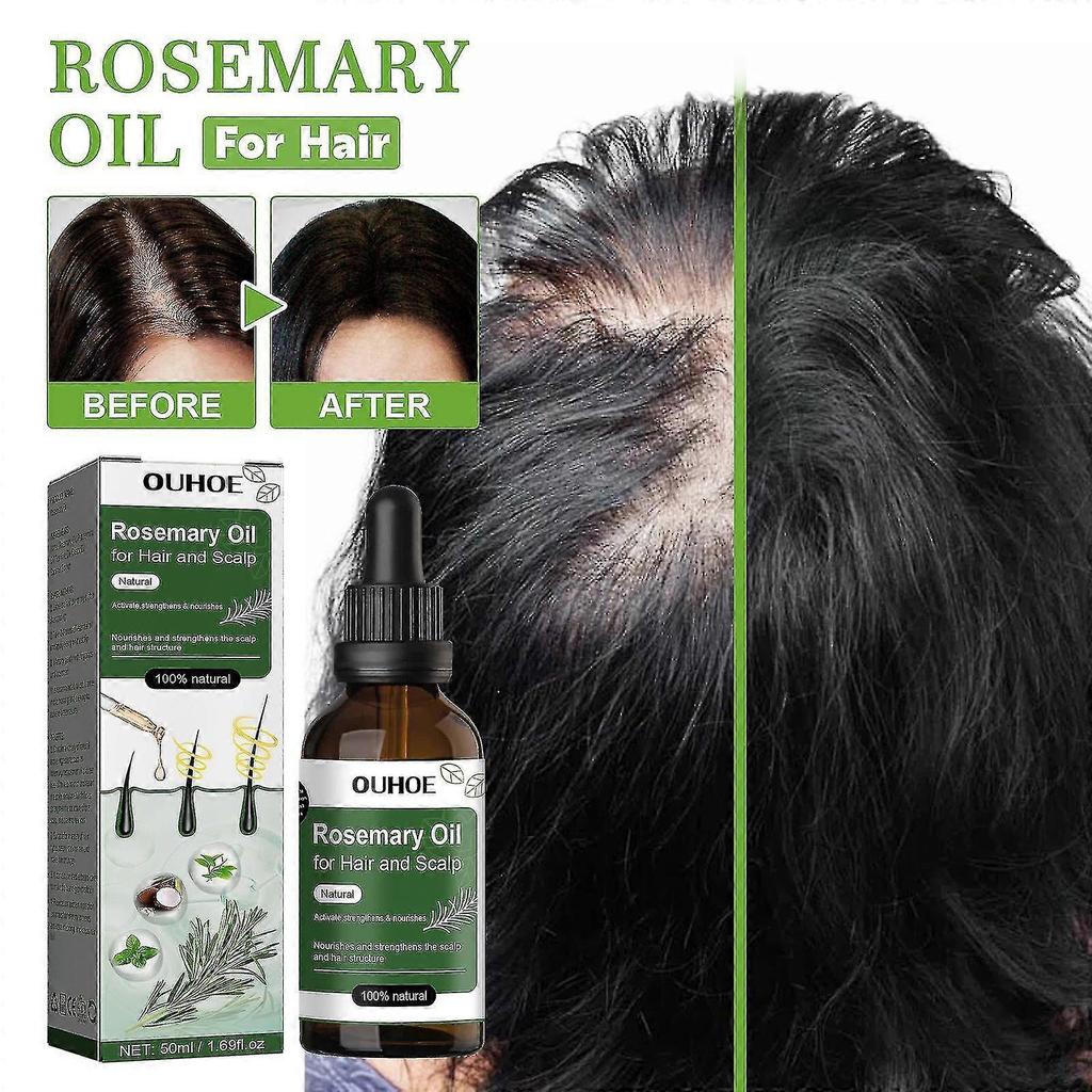 Rosemary Oil For Hair And Scalp - Hair Oil For Hair Loss To Stimulate Hair Growth And Care Of The Scalp With Castor Oil - Made In Germany - Pharmacy 5
