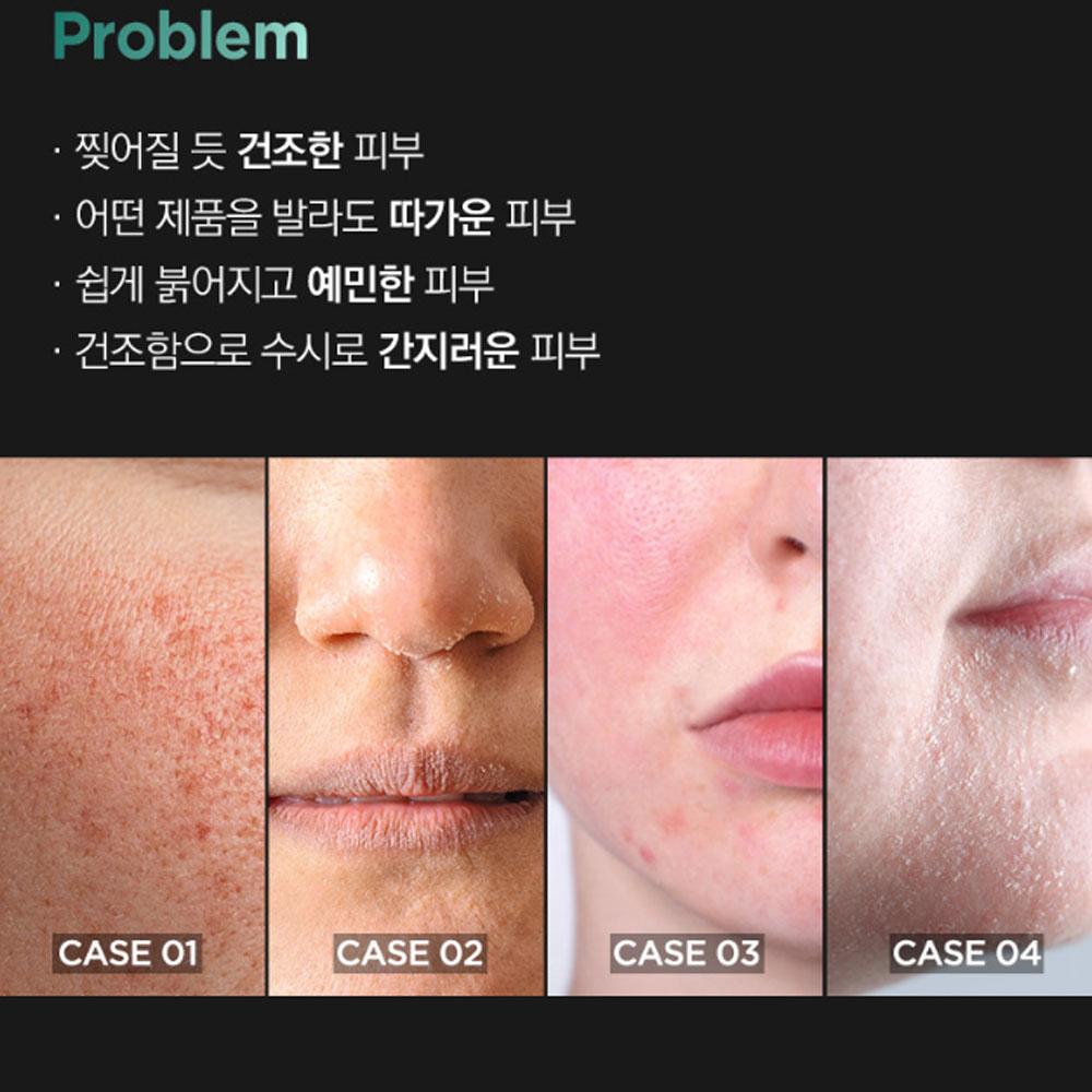 TOSOWOONG Dexpanthenol 170.000 ppm Creme 60ml