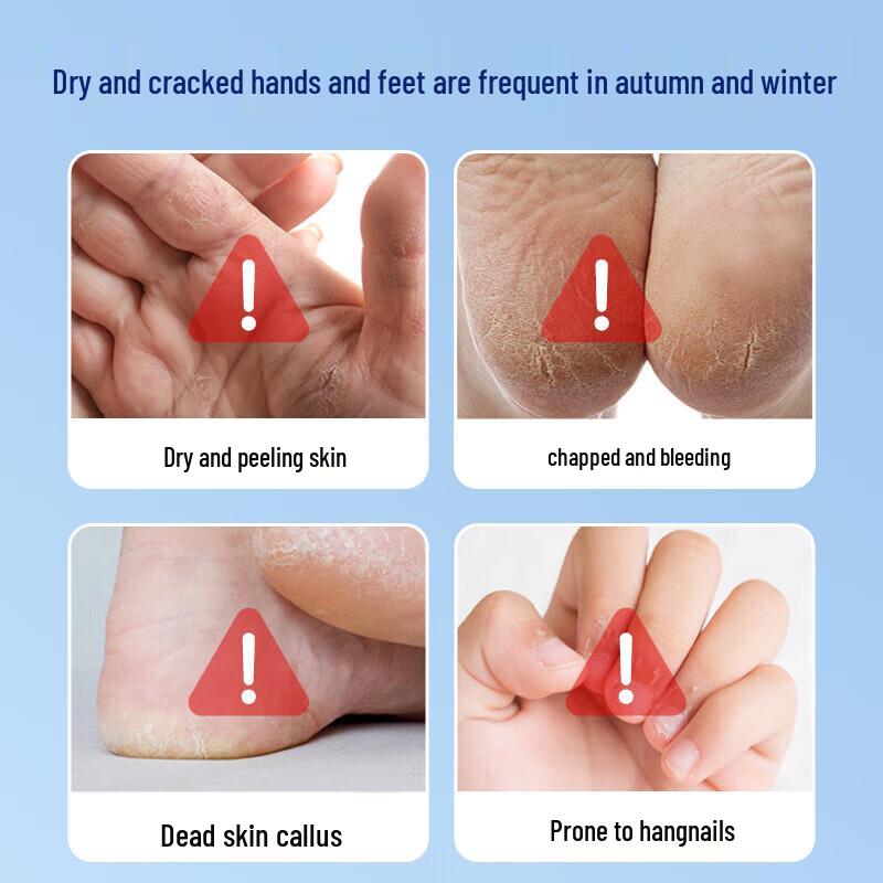 Haishi Hainuo Vaseline Cracked Patches