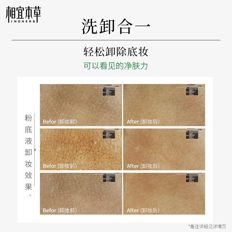 Suitable Herbal Core Cleansing Milk for Men and Women for Deep Skin Cleansing, Easy Makeup Removal and Oil Control