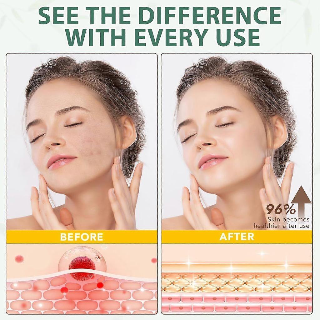 Grass-Fed Tallow Skin Care Cream 120g Moisturizing Face Body Balm Anti-Aging Beef Tallow Skin Care Kit