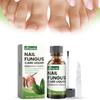 Conjunto Avançado Ximonth para Reparação de Unhas dos Pés e das Mãos para Cuidado de Unhas Saudáveis e Bonitas