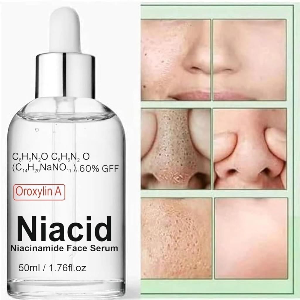 Niacid Niacinamide Face Serum with Oroxylin A, for Acne Marks, Blemishes and Pore Minimisation, 50ml