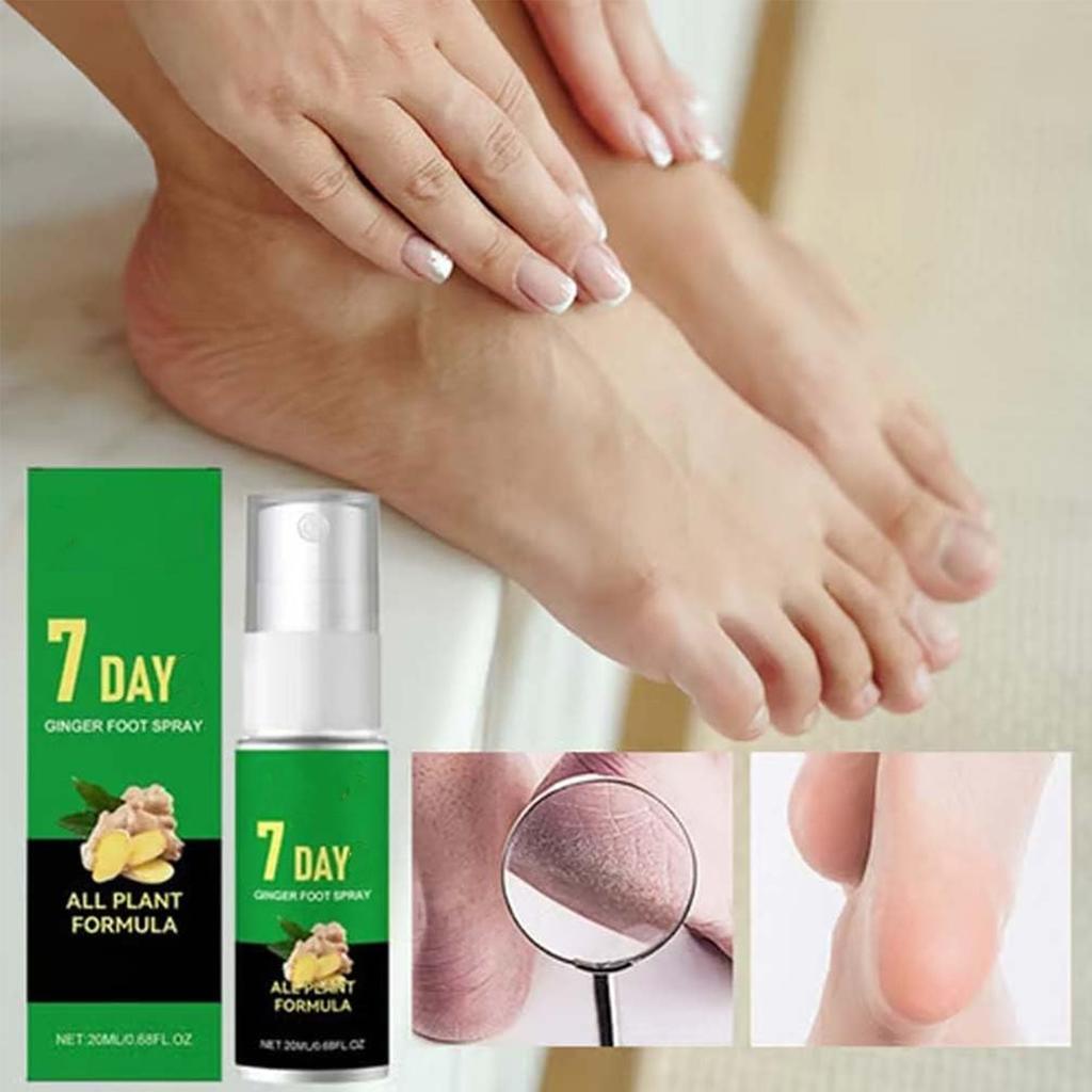 Lifesparking 7 Day Feet Callus Remover, 7 Day Ginger Foot Spray, Foot Ginger Nourishing Spray, Instant Feet Exfoliating Serum, Moisturizing & Smooth