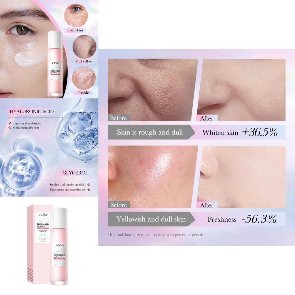 Sadoer Niacinamid Hautaufhellende Reparatur-Lotion für strahlende Haut und Fleckenbehandlung
