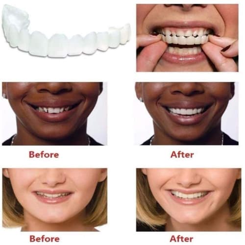 Two pairs of dentures, upper and lower dentures, temporary dentures for men and women, adjustable dentures, and natural, comfortable cosmetic crowns.