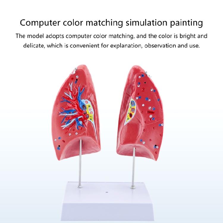 Anatomical Human Lung Model with Removable Parts Lung Anatomy Model Normal Lung Anatomy Model for Teaching Demonstration
