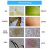 10.1inch Charging Type Microscope Scalp Hair Follicle Skin Hair Detector Analyser Machine 100‑240V