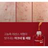 medicube - Red Acne Succinic Acid Peel