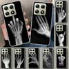 Autumu X Ray Hand Bones Phone Case Cover for Xiaomi Redmi Note 15 14 13 12 11 Pro Plus 14S 12S 11S 11T 11E 10S 10 Customized Fun