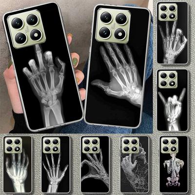 Huse pentru telefoane – Huse tip bumper pentru telefon