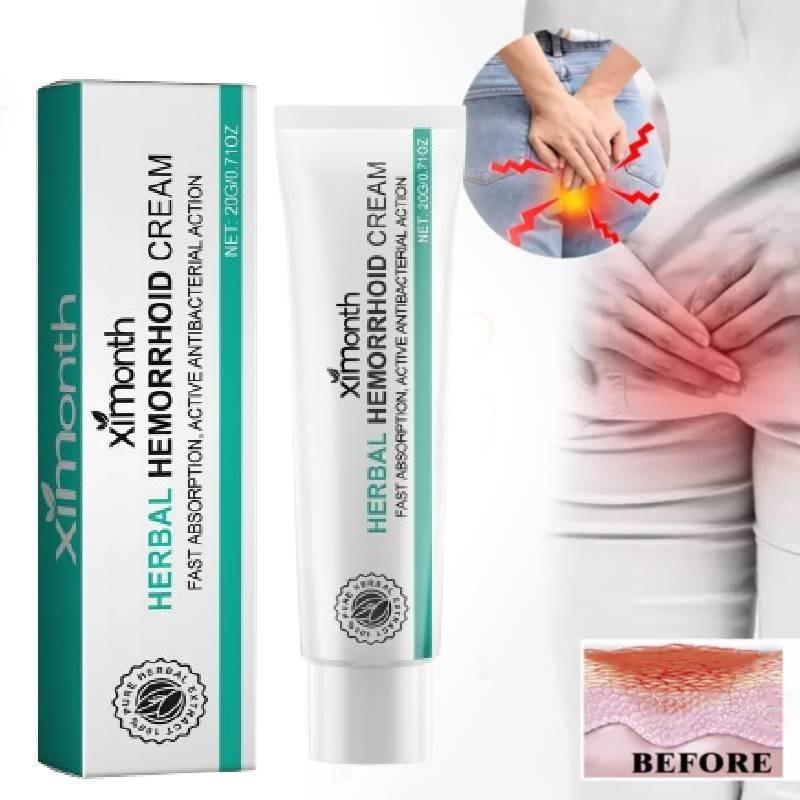 Ximonth Hemorrhoid Cream Soothing Relief For Anal Itching Discomfort And Pain