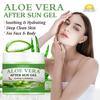 Aloe Vera After Sun Gel-Deep Cleansing and Moisturizing the Skin,Long-Lasting Soothing for Dry and Rough Skin,200g