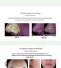4-in-1 Electric Waterproof Facial Cleansing Brush for Deep Cleaning & Blackhead Removal