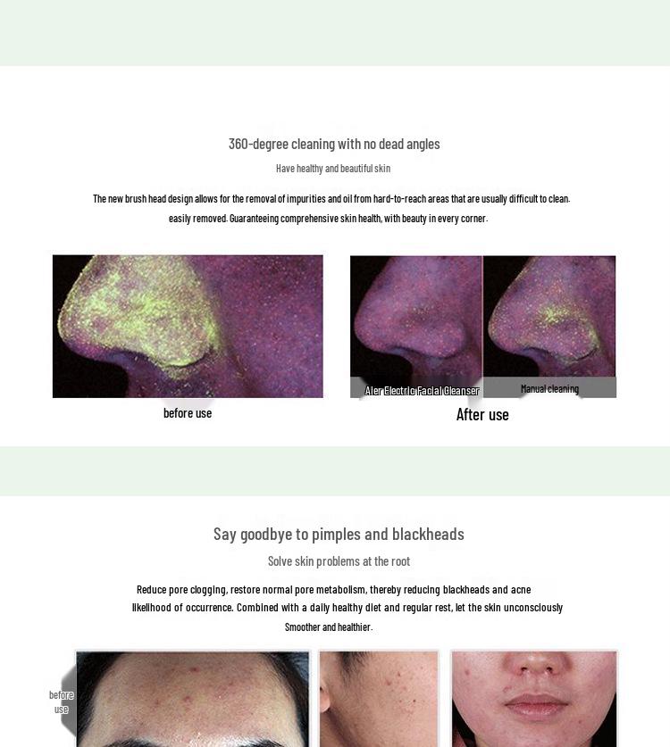 4-in-1 Electric Waterproof Facial Cleansing Brush for Deep Cleaning & Blackhead Removal