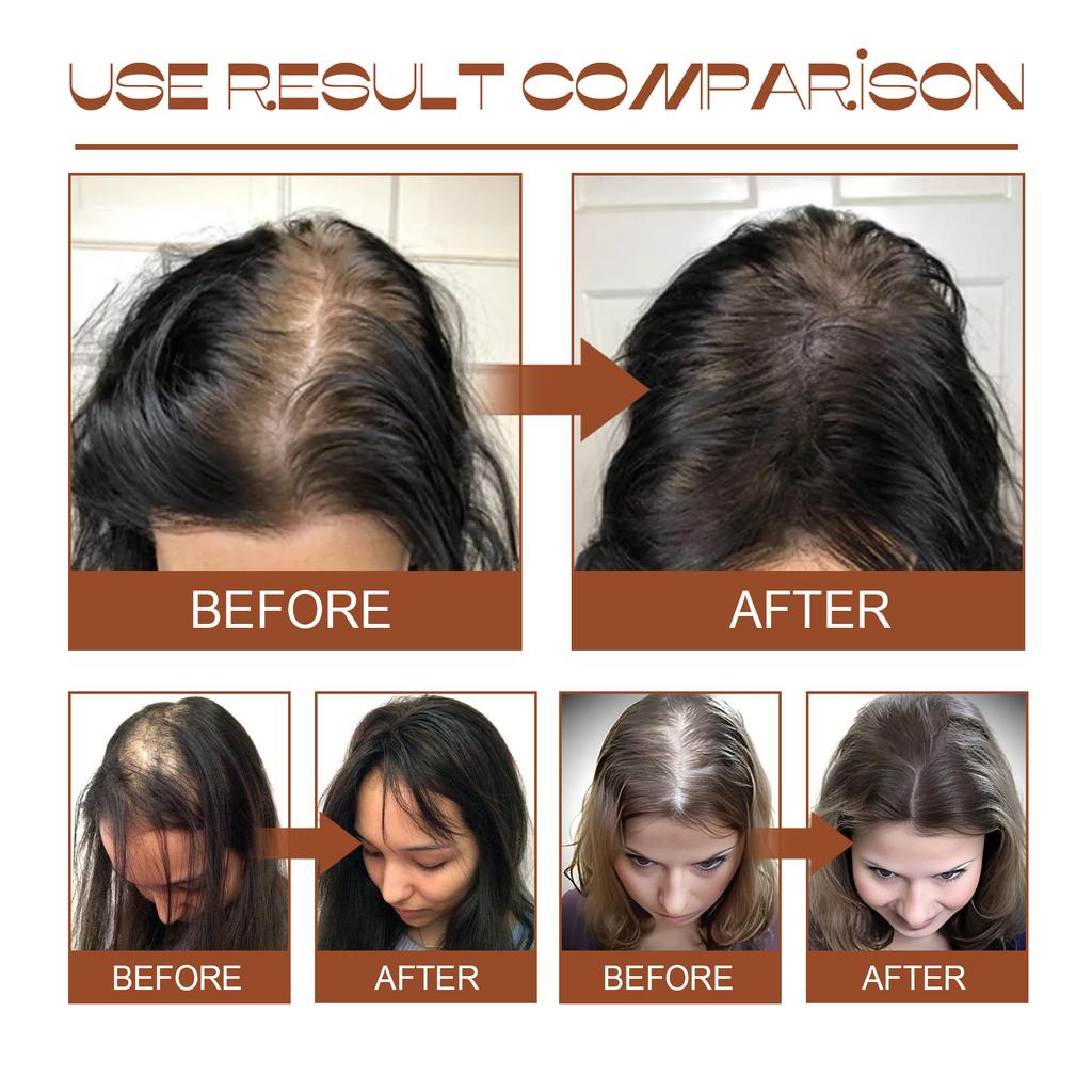 Maschera per Capelli 100% Puro Olio Biologico di Batana Trattamento Crescita Nutrire Ridurre la Caduta dei Capelli Anti-Rottura meno