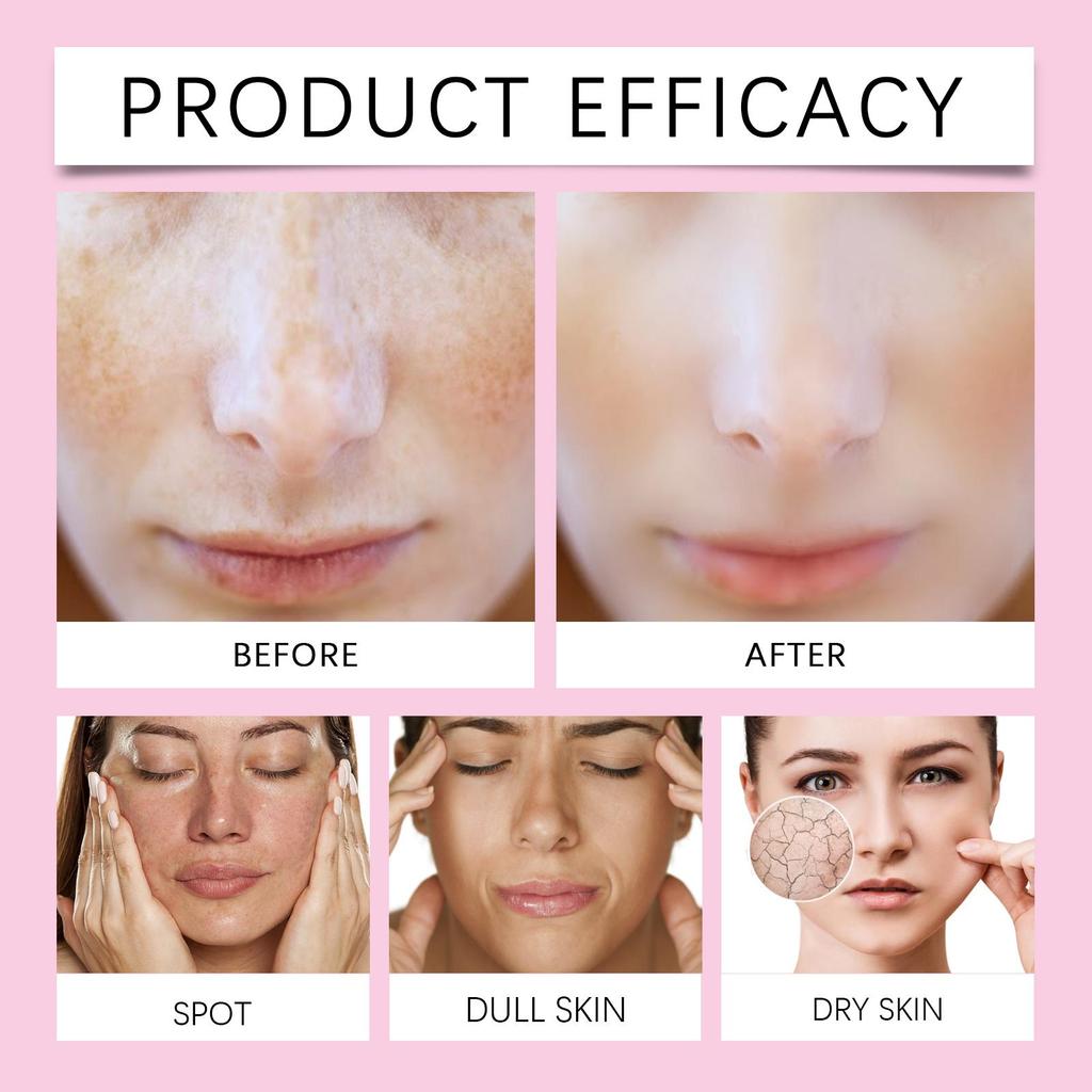 Kojic Acid Facial Cream Lighten Skin Tone Moisturizing Hydrating Smoothing Firm Face Reduce Dryness Discomfort Niacinamide Cream
