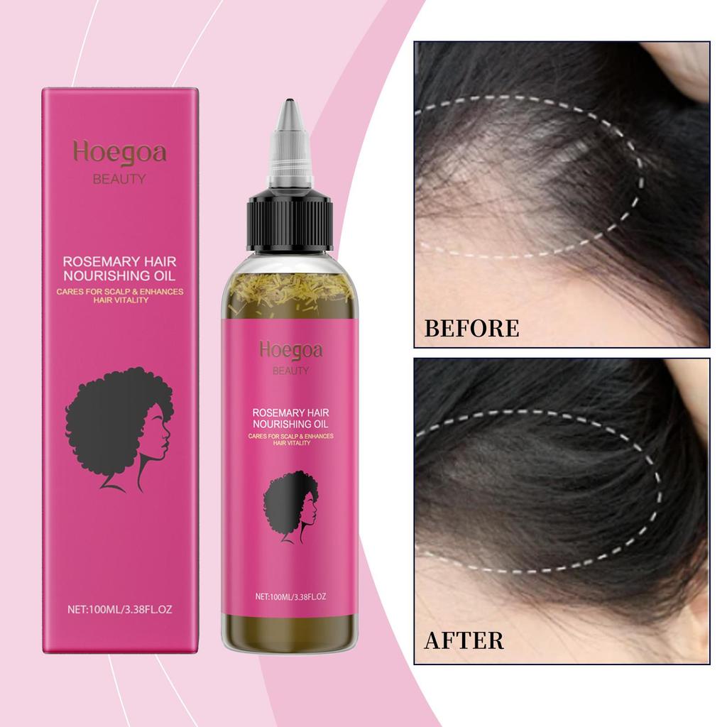 Hoegoa Olio Condizionante al Rosmarino Nutre, lenisce e liscia i capelli crespi per morbidezza e lucentezza.