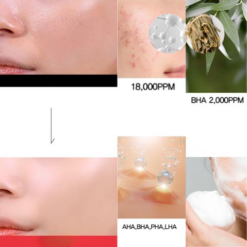 TOSOWOONG Salicylic Acid 18000ppm Foam Cleansing 100ml