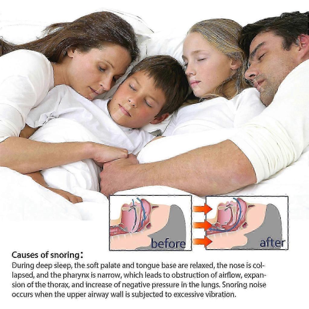 Anti-Snoring Tape Anti-Snoring Mouth Breathing Physical Expansion Nasal Sticker Anti-Snoring P