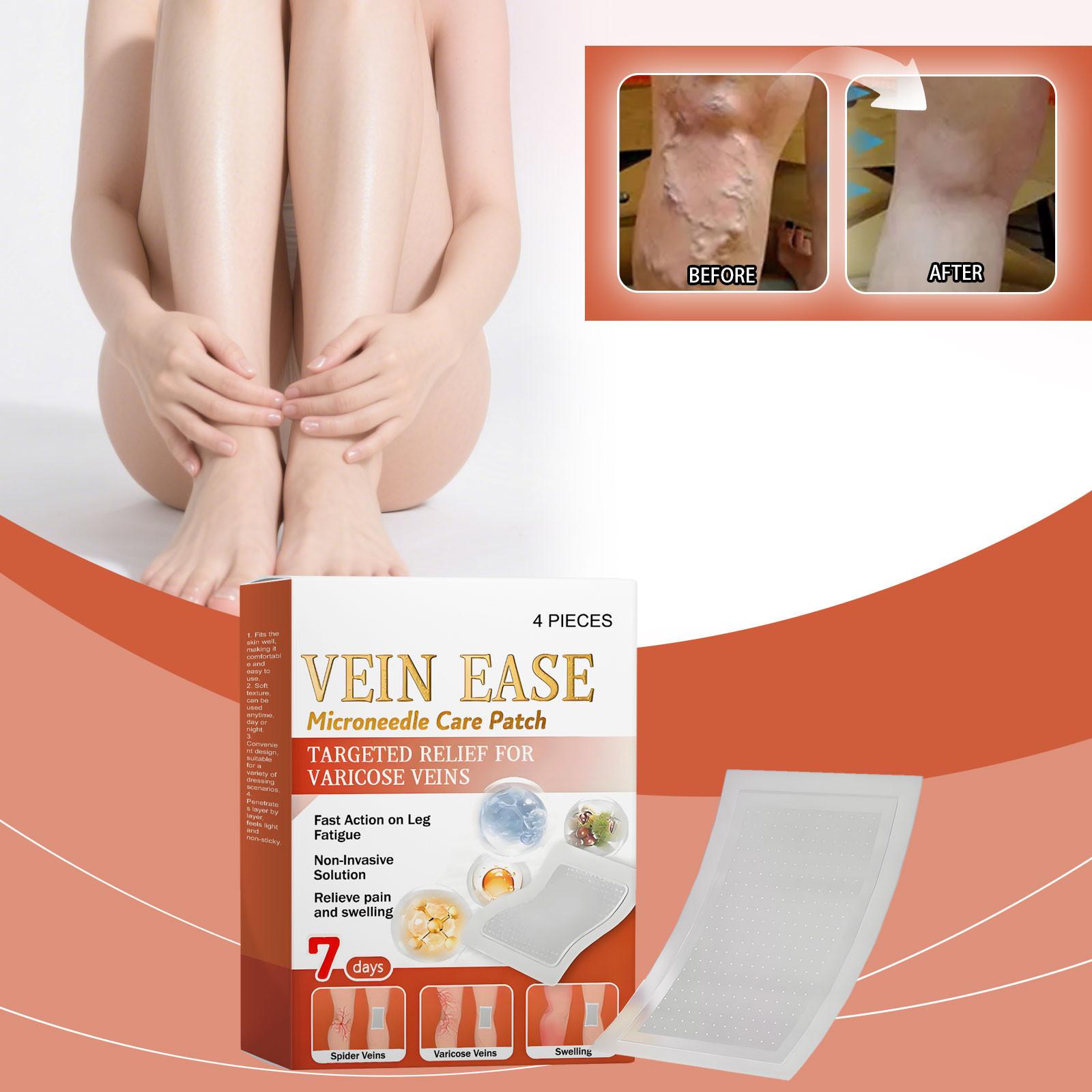 

Микроигольный пластырь для облегчения варикозного расширения вен на ногах улучшает кровообращение, обеспечивая воздухопроницаемость и комфорт. One Size белый