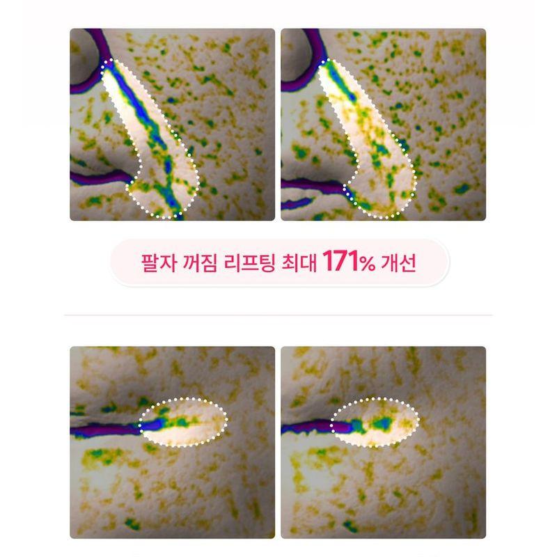 Dr.Melaxin - Cemenrete Cyano Pink Spicule Cream