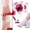 Jaysuing Fruit Acid Exfoliating Foot Mask Gently Exfoliates, Softens Calluses, Rejuvenates Skin, Moisturizes and Moisturizes Beautiful Feet