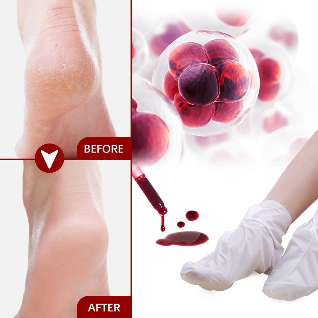 Jaysuing Fruit Acid Exfoliating Foot Mask Gently Exfoliates, Softens Calluses, Rejuvenates Skin, Moisturizes and Moisturizes Beautiful Feet