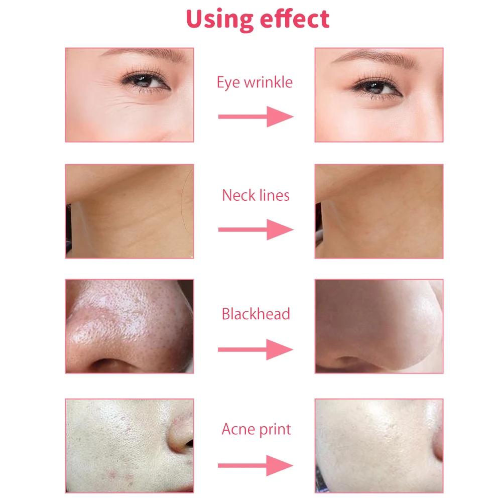 3 w 1 Urządzenie do mikrodermabrazji diamentowej Wysoka moc ssania Profesjonalna dermabrazja do użytku domowego Peeling twarzy Urządzenie do pielęgnacji skóry