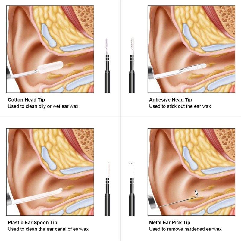 Smart Visual Ear Cleaner Ear Stick Endoscope Earpick Camera Otoscope Ear Cleaner Ear Wax Remover Ear Picker Ear Stick beleza PC