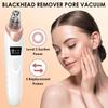 Deep Cleansing Vacuum Pore Cleaner 5 Suction Heads Face Cleansing Machine Facial Pores