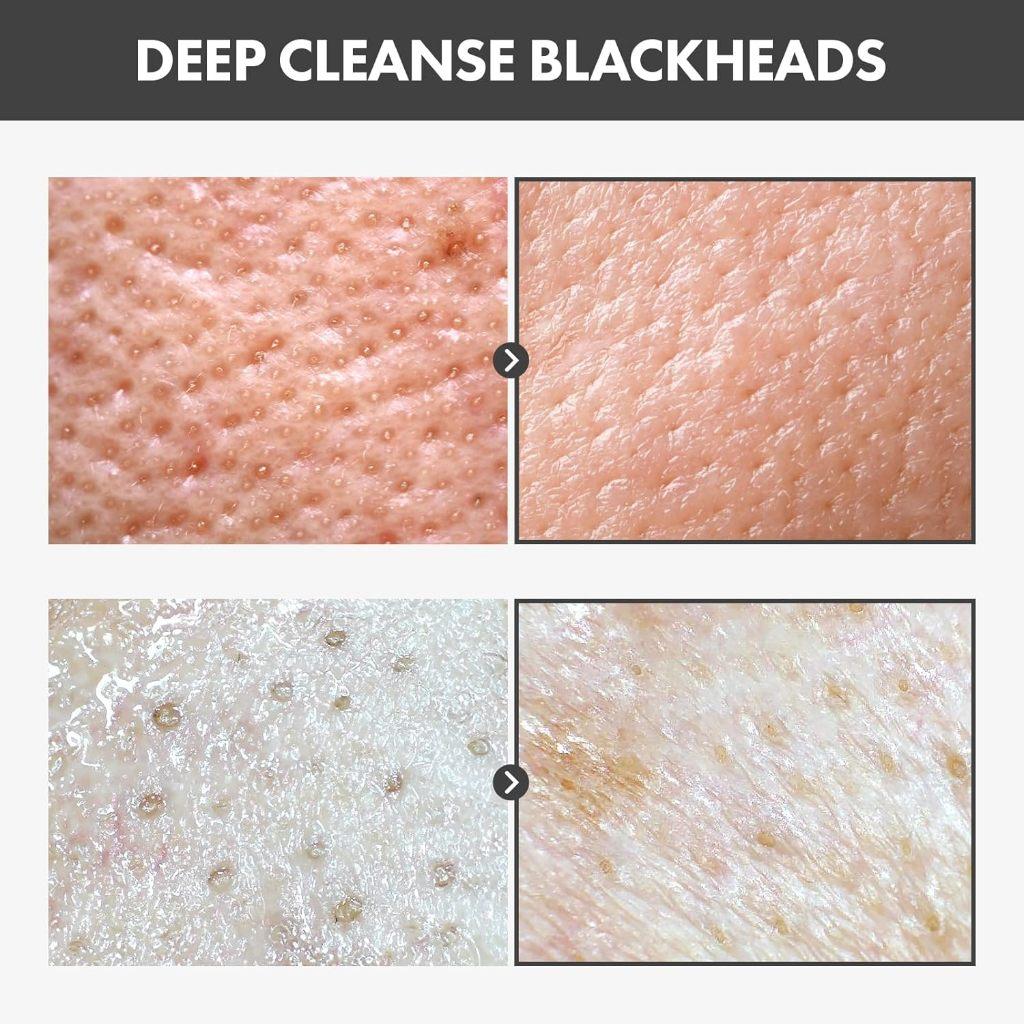 TOSOWOONG Black Head Peel Off Pack 50g