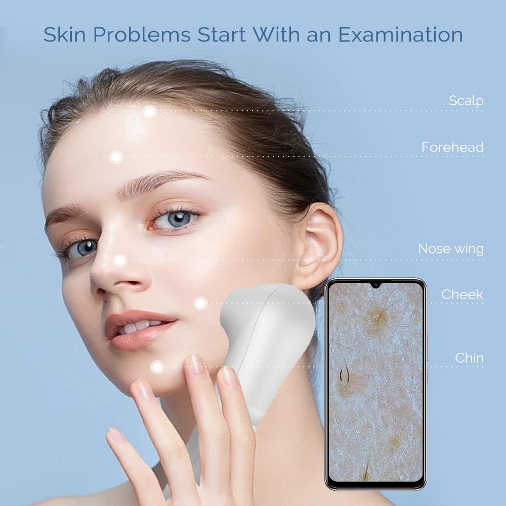 Multi-function Dermatoscope Scalp Facial Skin Analyzer Machine Skin Magnifier Scalp Diagnostic Device for Hair Follicle Testing