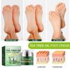 Hoygi Tea Tree Oil Foot Cream Repairs Cracked Heels, Prevents Dryness, Cracking And Peeling, And Moisturizes And Cares For The Feet