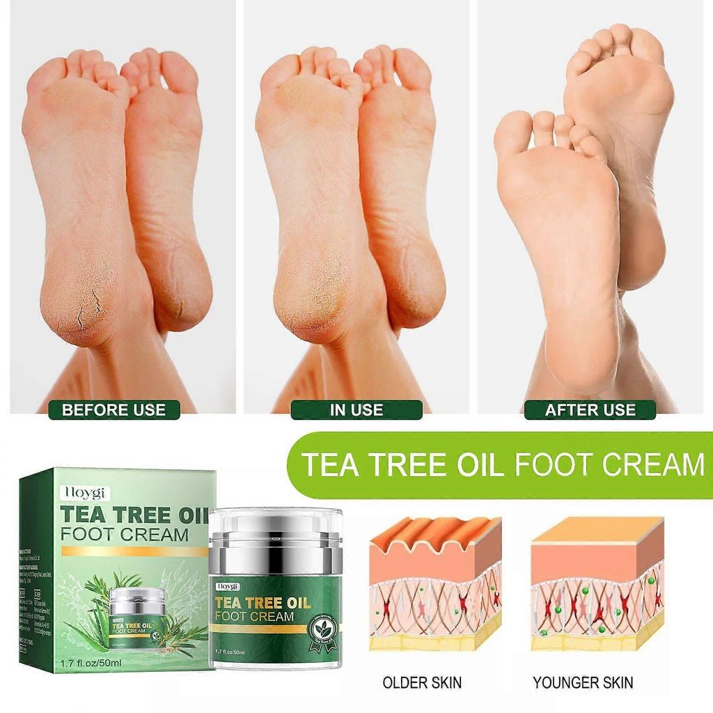 Hoygi Tea Tree Oil Foot Cream Repairs Cracked Heels, Prevents Dryness, Cracking And Peeling, And Moisturizes And Cares For The Feet