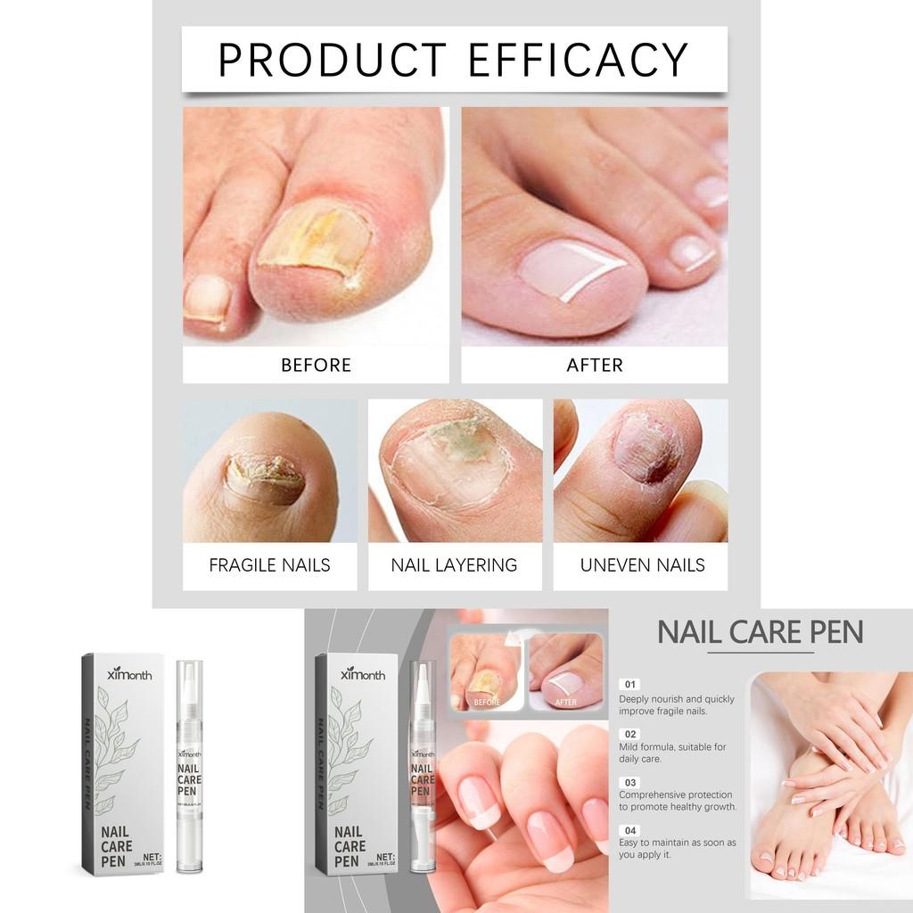 Ximonth Nagelpflege-Stift Nährende und feuchtigkeitsspendende Behandlung für gesunde Nägel