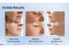 7 Color 3 Modes Facial & Neck Massager Skin Tightening Anti Aging Electric Beauty Device for Face Neck Rejuvenation