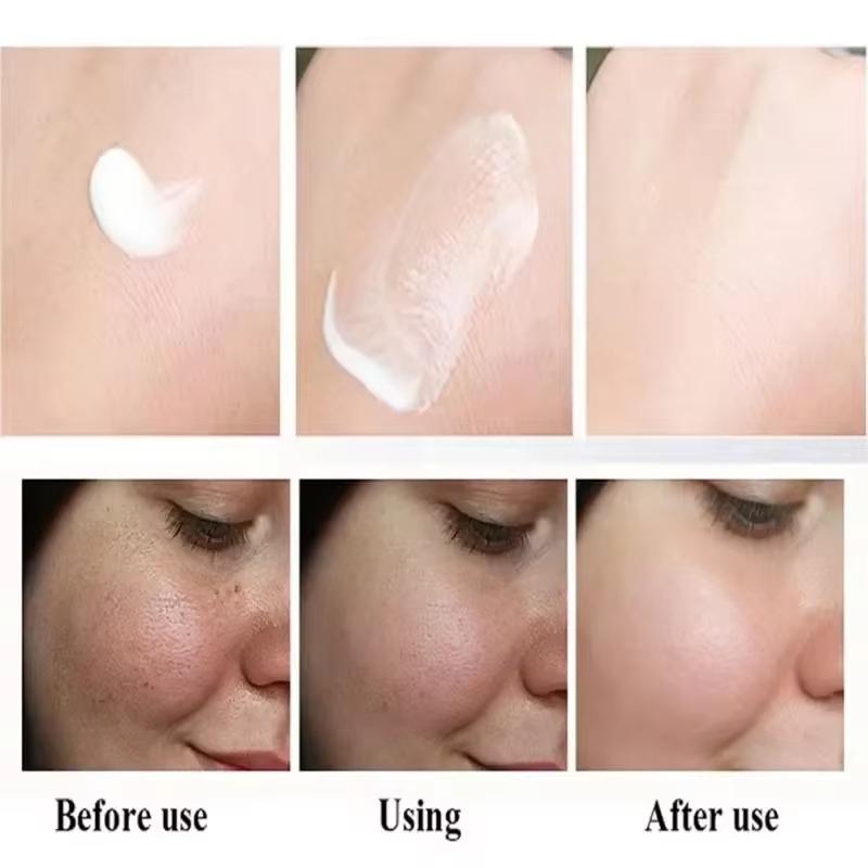 Crème blanchissante puissante anti-taches Éclaircit la peau rapidement Élimine la pigmentation mélanique Mélasma Taches brunes Soin de la peau coréen