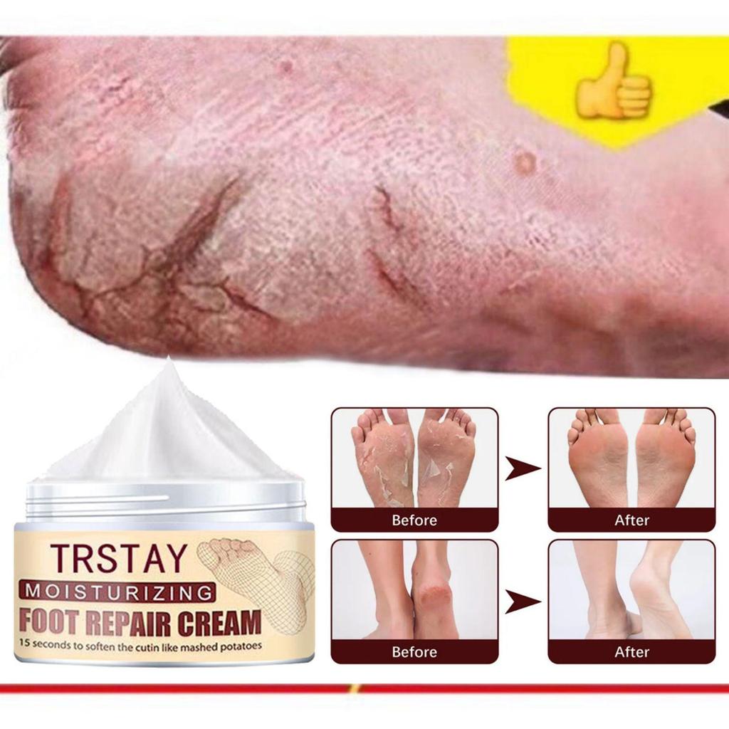 Nourishing Hand And Foot Mask Set With Moisturizing Foot Cream, For Smooth And Glowing Skin