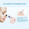 EMS Ion Ultrasonic Facial Cleaner Skin Peeling Face Pores Deep Cleansing Cuticles Removal Scrub