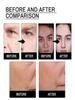 Face Essence Essential Oils Anti Wrinkle Anti-aging Lighten Spots Brightening Facial Skin Fade Remove Freckle Speckle Care